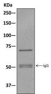 Western blot analysis on immunoprecipitation pellet from HepG2 cell lysate immunoprecipitated using ab172617 at 1/10 dilution.