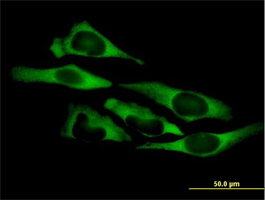 ab72957, at 10µg/ml, staining QARS in HeLa cells by immunofluorescence.
