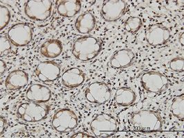 QARS antibody (ab55644) used in immunohistochemistry at 3ug/ml on formalin fixed and paraffin embedded human colon.