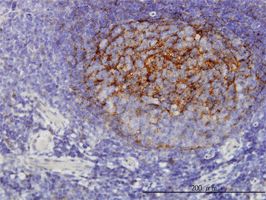 QPRT antibody (ab57125) used in immunohistochemistry at 3ug/ml on formalin fixed and paraffin embedded human tonsil.