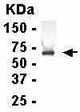 Anti-QPRT antibody (ab37515) at 1/2000 dilution + E. coli-derived fusion protein at 2.5 µgSecondaryGoat anti-IgY-HRP at 1/1000 dilution