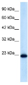 Anti-RAB14 antibody (ab28639) at 0.5 µg/ml + Raji cell lysate 10ug.SecondaryHRP conjugated anti-Rabbit IgG 