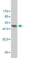 Western blot against tagged recombinant protein immunogen using ab56399 Rab17 antibody at 1ug/ml.