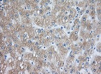 ab118998, at 1/50 dilution, staining Rab17 in paraffin embedded Human liver tissue by Immunohistochemistry.
