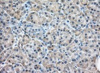 ab118998, at 1/50 dilution, staining Rab17 in paraffin embedded Human pancreas tissue by Immunohistochemistry.