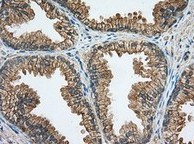 ab118998, at 1/50 dilution, staining Rab17 in paraffin embedded Human prostate tissue by Immunohistochemistry.