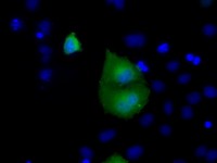 ab118998 at 1/100 dilution staining Rab17 in COS7 cells transiently transfected with pCMV6-ENTRY Rab17 by Immunofluorescence.
