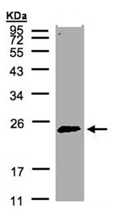 Anti-Rab2 antibody (ab96509) at 1/500 dilution + Hela S3 whole cell lysate at 30 µg