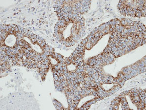 Immunohistochemical analysis of paraffin-embedded endo mitral OCVA, using ab96509 at 1:100 dilution.