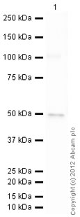 Anti-Rab2 antibody (ab96509) at 1/500 dilution + Active human Rab2 full length protein (ab90797) at 0.01 µgSecondaryGoat Anti-Rabbit IgG H&L (HRP) preadsorbed (ab97080) at 1/5000 dilutiondeveloped using the ECL techniquePerformed under reducing conditions.Exposure time : 20 seconds