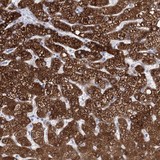 ab122427, at a 1/200 dilution, staining NRAP in paraffin embedded Human liver tissue by Immunohistochemistry.