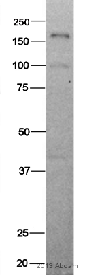 Anti-NRAP antibody (ab122427) at 1/1000 dilution + Sheep cardiac tissue at 10 µgSecondaryDonkey Anti-Rabbit IgG (H+L) at 1/20000 dilutiondeveloped using the ECL techniquePerformed under reducing conditions.Observed band size : 190 kDa (why is the actual band size different from the predicted?)Exposure time : 50 secondsThis image is courtesy of an anonymous abreview.See Abreview