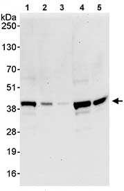 All lanes : Anti-NRBF2 antibody (ab85733) at 0.4 µg/mlLane 1 : Whole cell lysate from HeLa cells at 50 µgLane 2 : Whole cell lysate from HeLa cells at 15 µgLane 3 : Whole cell lysate from HeLa cells at 5 µgLane 4 : Whole cell lysate from 293T cells at 50 µgLane 5 : Whole cell lysate from NIH3T3 cells at 50 µgdeveloped using the ECL technique