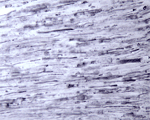 IHC on rat ligated sciatic nerve using ab68828 at 1 : 1000 dilution. Pre-absorption of the antibody with the immunising peptide completely abolishes the immunostaining (not shown).