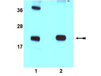 All lanes : Anti-Rac1 antibody (ab78139) at 1/1000 dilutionLane 1 : HeLa cell lysateLane 2 : MCF7 cell lysateSecondaryGoat anti-Rabbit HRP-conjugated at 1/5000 dilutionObserved band size : 22 kDa (why is the actual band size different from the predicted?)Additional bands at : 38 kDa. We are unsure as to the identity of these extra bands.