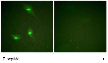 Immunofluorescence analysis of HeLa cells, using ab61078 at a 1/500 dilution, minus immunising peptide (left image) and plus immunising peptide (right image).