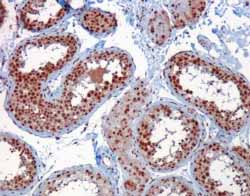 ab2270 (1µg/ml) staining Human Testis by IHC-P. Microwaved antigen retrieval with Tris/EDTA buffer (pH9), HRP-staining.