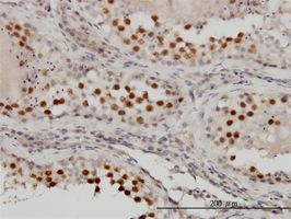 RACGAP1 antibody (ab57081) used in immunohistochemistry at 1ug/ml on formalin fixed and paraffin embedded human testis.
