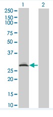 All lanes : Anti-Rad1 antibody (ab76830) at 5 µg/mlLane 1 : Rad1 transfected 293T cell line Lane 2 : Non transfected 293T cell line Lysates/proteins at 25 µg per lane.SecondaryGoat Anti-Mouse IgG (H&L)-HRP Conjugate at 1/2500 dilution
