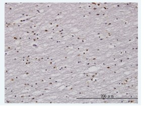 Immunohistochemical analysis of formalin-fixed paraffin-embedded human lateral ventricle wall using ab 76830 at 3 µg/ml.