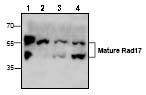 All lanes : Anti-Rad17 antibody (ab69817) at 0.5 µg/mlLane 1 : Rat kidney lysateLane 2 : 3T3 cell lysateLane 3 : Jurkat cell lysateLane 4 : Jurkat cell lysate
