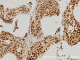 RAD18 antibody (ab57447) used in immunohistochemistry at 3ug/ml on formalin fixed and paraffin embedded human testis.