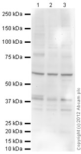 All lanes : Anti-Rad51 (phospho T309) antibody (ab31769) at 1 µg/mlLane 1 : Jurkat (Human T cell lymphoblast-like cell line) Whole Cell Lysate Lane 2 : Ramos (Human Burkitt's lymphoma cell line) Whole Cell Lysate Lane 3 : Y79 (Human retinoblastoma cell line) Whole Cell Lysate Lysates/proteins at 10 µg per lane.SecondaryGoat Anti-Rabbit IgG H&L (HRP) preadsorbed (ab97080) at 1/10000 dilutiondeveloped using the ECL techniquePerformed under reducing conditions.Observed band size : 39 kDa (why is the actual band size different from the predicted?)Additional bands at : 34 kDa,60 kDa. We are unsure as to the identity of these extra bands.Exposure time : 20 minutes