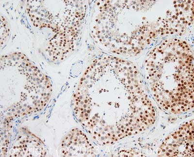 IHC image of Rad51 (phospho T309) staining in human testis formalin fixed paraffin embedded tissue section, performed on a Leica BondTM system using the standard protocol F. The section was pre-treated using heat mediated antigen retrieval with sodium citrate buffer (pH6, epitope retrieval solution 1) for 20 mins. The section was then incubated with ab31769, 1µg/ml, for 15 mins at room temperature and detected using an HRP conjugated compact polymer system. DAB was used as the chromogen. The section was then counterstained with haematoxylin and mounted with DPX. For other IHC staining systems (automated and non-automated) customers should optimize variable parameters such as antigen retrieval conditions, primary antibody concentration and antibody incubation times.