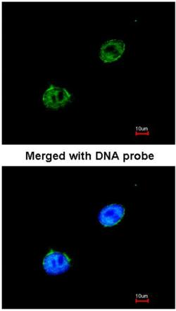 Immunofluorescence analysis of paraformaldehyde-fixed HeLa cells staining Rad51, using ab137323 (green) at a 1/200 dilution. Cell nuclei are shown in blue.
