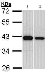 All lanes : Anti-Rad51 antibody (ab137323) at 1/1000 dilutionLane 1 : H1299 whole cell lysateLane 2 : HepG2 whole cell lysateLysates/proteins at 30 µg per lane.