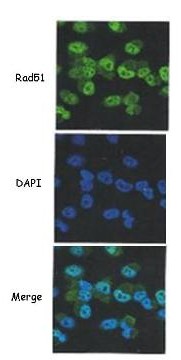 Immunofluorescence analysis of paraformaldehyde-fixed H1299, labelling Rad51 using ab137323 at 1/400 dilution. Middle panel cell nuclei are shown in blue. Lower panel merged.
