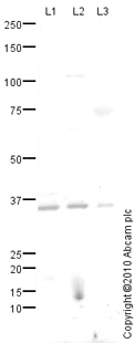 All lanes : Anti-Rad51 antibody (ab84304) at 1 µg/mlLane 1 : HeLa (Human epithelial carcinoma cell line) Whole Cell Lysate Lane 2 : HeLa (Human epithelial carcinoma cell line) Nuclear LysateLane 3 : Testis (Human) Tissue Lysate - adult normal tissue (ab30257)Lysates/proteins at 10 µg per lane.SecondaryGoat polyclonal to Rabbit IgG - H&L - Pre-Adsorbed (HRP) at 1/3000 dilutiondeveloped using the ECL techniquePerformed under reducing conditions.