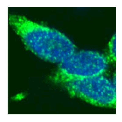 Staining of HEK293 cells with anti Rad51 antibody (ab46981, 1 µg/ml) in green, and DAPI in blue.