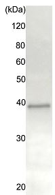ab176458 (20 µg) was incubated with 20 μg of HeLa cell extract, and precipitated with 20 μg of proteinA-beads. The sample was dissociated from the precipitate by heating in SDS-sample buffer and analyzed by western blotting with anti-Rad51 antiserum (chicken, ab63802) at 1/1000 dilution. As secondary antibody, anti-chicken IgG antibody (rabbit) was used at 1/10000 dilution.