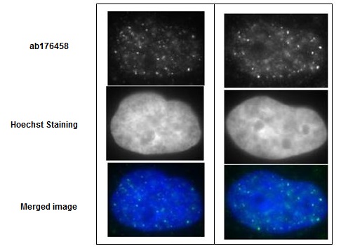 Immunofluorescence detection of Rad51 foci formation after X-ray irradiation in GM0637 cells with ab176458 at 1/10000 dilution (left panels) and 1/1000 dilution (right panels). The secondary antibody, anti-rabbit Alexa 488 was used at 1/10000 dilution. Cells were irradiated by X-rays at 2 Gy, grown for 1 hr, fixed with 4% paraformaldehyde in 1x PBS for 10 min, washed 3 times with PBS for 3 min, permealized by treatment with 0.5% Triton for 5 min, washed 3 times with PBS for 3 min, incubated with ab176458 for 30 min at 37°C, washed 3 times with PBS for 3 min, incubated with secondary antibody for 30 min at 37°C, washed 3 times with PBS for 3 min, stained with Hoechst for 1 min and mounted. The pictures were by courtesy of Prof. S. Tashiro and Dr. K. Kono at Hiroshima University.
