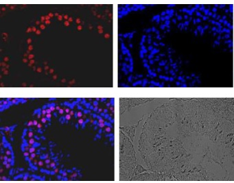 Immunohistological staining of Rad51 protein in mouse testis using ab176458. A section of formalin fixed and paraffin embedded mouse testis was treated with ab176458 at 1/100 dilution after deparaffization and antigen retrieval. The secondary antibody, Alexa Fluor® 647conjugated anti-rabbit IgG was used at 1/1,000 dilution (top left). The sample was counter-stained with DAPI (top right) and the merged image is shown (bottom left). The white light image of the same region is shown on the bottom right.