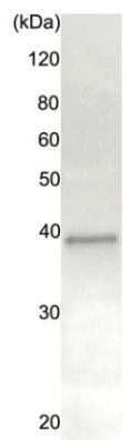Immunoprecipitation of Rad51 protein from crude extract of HeLa cells by ab179897.ab179897 (20 µg) was incubated with 20 µg of HeLa cell extract, and precipitated with 20 μg of protein A-beads. The sample was dissociated from the precipitate by heating in SDS-sample buffer and analyzed by western blotting with anti-Rad51 antiserum (chicken, ab63802) at 1/1000 dilution. As secondary antibody, anti-chicken IgG antibody (rabbit) was used at 1/10000 dilution.