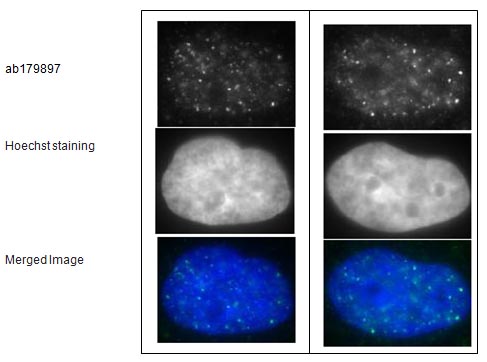 Immunofluorescent detection of Ra51 foci formation after X-ray irradiation in human fibroblast cell line, GM0637.Cells were irradiated by X-rays at 2 Gy, grown for 1 hr, fixed with 4% paraformaldehyde in 1x PBS for 10 min, washed 3 times with PBS for 3 min, permealized by treatment with 0.5% Triton for 5 min, washed 3 times with PBS for 3 min, incubated with ab179897 for 30 min at 37°C, washed 3 times with PBS for 3 min, incubated with secondary antibody for 30 min at 37°C, washed 3 times with PBS for 3 min, stained with Hoechst for 1 min and mounted. ab179897 was used at 1/10000 dilution (left panels) and 1/1000 dilution (right panels). As the secondary antibody, anti-rabbit Alexa 488 was used at 1/10000 dilution.The pictures were by courtesy of Prof. S. Tashiro and Dr. K. Kono at Hiroshima University.