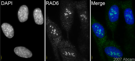 ab31917 (1/200) stainning Rad6 in RPE-1 cells (green). Cells were fixed in paraformaldehyde, permeabilised with Triton X100 and counterstained with DAPI in order to highlight the nucleus (blue). Please refer to abreview for further details.See Abreview