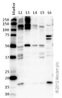 All lanes : Anti-Rad6 antibody (ab31917) at 1 µg/mlLane 1 : MarkerLane 2 : Zebrafish brain homogenateLane 3 : Zebrafish heart homogenateLane 4 : Zebrafish liver homogenateLane 5 : Zebrafish skeletal muscle homogenateLane 6 : HeLa (Human epithelial carcinoma cell line) Whole Cell Lysate Lysates/proteins at 10 µg per lane.SecondaryGoat polyclonal to Rabbit IgG – H&L – Pre-Adsorbed (HRP) at 1/6000 dilutiondeveloped using the ECL techniquePerformed under reducing conditions.