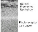 Ab3611 used in IHC (frozen) in transgenic mouse retinas.