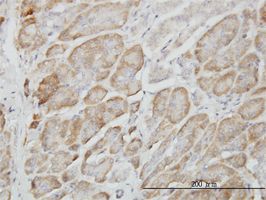 RAGEF2 antibody (ab57221) used in immunohistochemistry at 3ug/ml on formalin fixed and paraffin embedded human pancreas.