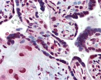 ab110914, at 10 µg/ml, staining RAIDD in formalin fixed, paraffin embedded Human placenta tissue by Immunohistochemistry. Biotinylated secondary antibody, followed by alkaline phosphatase-streptavidin and chromogen was used to develop the staining.