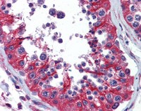 ab110914, at 10 µg/ml, staining RAIDD in formalin fixed, paraffin embedded Human testis by Immunohistochemistry. Biotinylated secondary antibody, followed by alkaline phosphatase-streptavidin and chromogen was used to develop the staining.