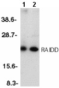 All lanes : Anti-RAIDD antibody (ab8426) at 1/500 dilutionLane 1 : HeLa whole cell lysateLane 2 : K562 whole cell lysateObserved band size : 22 kDa (why is the actual band size different from the predicted?)