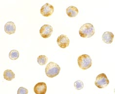 ab8426 at 5µg/ml staining RAIDD in Hela cells by ICC/IF