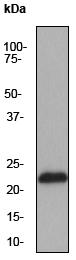 Anti-RAIDD antibody [EPR1640Y] (ab52621) at 1/1000 dilution + HeLa cell lysate at 10 µgSecondarygoat anti-rabbit HRP at 1/2000 dilution
