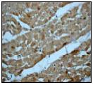 ab52621, at a 1/50 dilution, staining Human RAIDD in heart muscle, using Immunohistochemistry, Paraffin embedded tissue.
