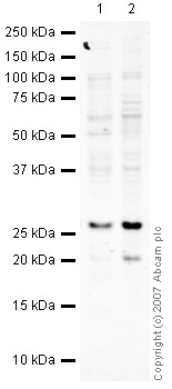 All lanes : Anti-RALA+RALB antibody (ab42532) at 1 µg/mlLane 1 : HepG2 (Human hepatocellular liver carcinoma cell line) Whole Cell Lysate (ab7900)Lane 2 : MDA MB 361 (Human breast adenocarcinoma cell line) Whole Cell LysateLysates/proteins at 10 µg per lane.SecondaryIRDye 680 Conjugated Goat Anti-Rabbit IgG (H+L) at 1/10000 dilutionPerformed under reducing conditions.