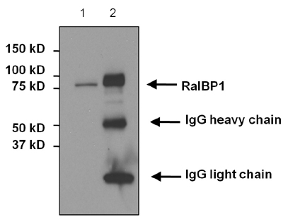 Immunoprecipitation of RALBP1 was performed on 293T cells. The antigen:antibody complex was formed by incubating 750 µg whole cell lysate with 2 µg of ab175357 (lane 2). Lane 1 shows lysate only control. For WB detectiion, ab175357 was used at 1/1000 dilution.